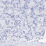 FGFBP1 Antibody in Immunohistochemistry (IHC)