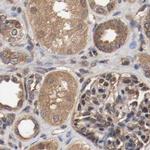 AFG3L2 Antibody in Immunohistochemistry (IHC)