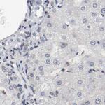 AFG3L2 Antibody in Immunohistochemistry (IHC)