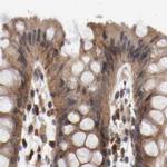 AFG3L2 Antibody in Immunohistochemistry (IHC)