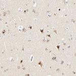 DAZAP1 Antibody in Immunohistochemistry (Paraffin) (IHC (P))