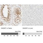 DAZAP1 Antibody in Immunohistochemistry (IHC)