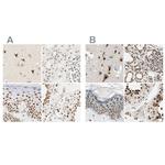 DAZAP1 Antibody in Immunohistochemistry (IHC)