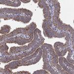 Arylsulfatase D Antibody in Immunohistochemistry (IHC)