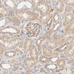 GSTZ1 Antibody in Immunohistochemistry (Paraffin) (IHC (P))