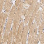 GSTZ1 Antibody in Immunohistochemistry (Paraffin) (IHC (P))