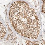 GSTZ1 Antibody in Immunohistochemistry (Paraffin) (IHC (P))