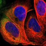 PDE5 Antibody in Immunocytochemistry (ICC/IF)