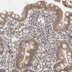 PDE5 Antibody in Immunohistochemistry (Paraffin) (IHC (P))