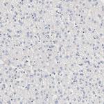 PDE5 Antibody in Immunohistochemistry (Paraffin) (IHC (P))