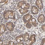 PDE5 Antibody in Immunohistochemistry (IHC)