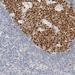 MEF2B Antibody in Immunohistochemistry (Paraffin) (IHC (P))