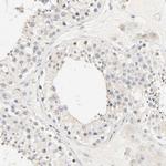 MEF2B Antibody in Immunohistochemistry (Paraffin) (IHC (P))