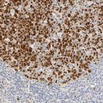 MEF2B Antibody in Immunohistochemistry (Paraffin) (IHC (P))