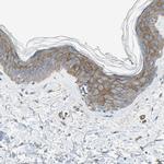 Filamin B Antibody in Immunohistochemistry (IHC)