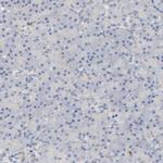 UCKL1 Antibody in Immunohistochemistry (Paraffin) (IHC (P))