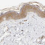 UCKL1 Antibody in Immunohistochemistry (Paraffin) (IHC (P))