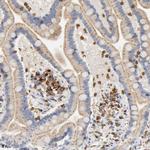 UCKL1 Antibody in Immunohistochemistry (Paraffin) (IHC (P))