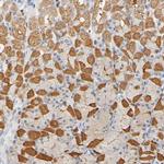 UCKL1 Antibody in Immunohistochemistry (Paraffin) (IHC (P))