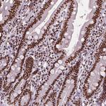 AKAP8 Antibody in Immunohistochemistry (Paraffin) (IHC (P))