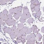 AKAP8 Antibody in Immunohistochemistry (Paraffin) (IHC (P))