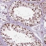 AKAP8 Antibody in Immunohistochemistry (Paraffin) (IHC (P))