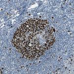 MCM3 Antibody in Immunohistochemistry (Paraffin) (IHC (P))