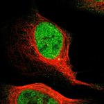 MCM3 Antibody in Immunocytochemistry (ICC/IF)