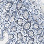 MCM3 Antibody in Immunohistochemistry (Paraffin) (IHC (P))