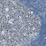 MCM3 Antibody in Immunohistochemistry (Paraffin) (IHC (P))