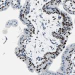 MCM3 Antibody in Immunohistochemistry (Paraffin) (IHC (P))