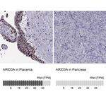 DRIL1 Antibody in Immunohistochemistry (IHC)