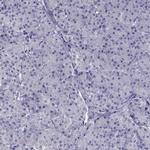 DRIL1 Antibody in Immunohistochemistry (IHC)