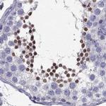 DRIL1 Antibody in Immunohistochemistry (IHC)