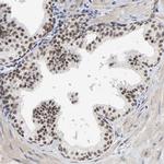 GRHL2 Antibody in Immunohistochemistry (IHC)