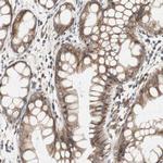 H6PD Antibody in Immunohistochemistry (Paraffin) (IHC (P))