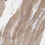 H6PD Antibody in Immunohistochemistry (Paraffin) (IHC (P))