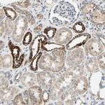 NNT Antibody in Immunohistochemistry (Paraffin) (IHC (P))