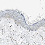 NNT Antibody in Immunohistochemistry (Paraffin) (IHC (P))