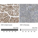 NNT Antibody in Immunohistochemistry (IHC)