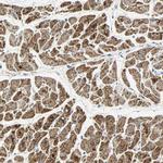 NNT Antibody in Immunohistochemistry (IHC)