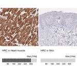 HRC Antibody in Immunohistochemistry (IHC)