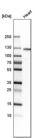 HRC Antibody in Western Blot (WB)