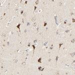 ZMAT5 Antibody in Immunohistochemistry (Paraffin) (IHC (P))