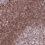 RASL11A Antibody in Immunohistochemistry (Paraffin) (IHC (P))