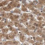 GALT Antibody in Immunohistochemistry (IHC)