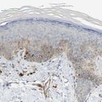 MFI2 Antibody in Immunohistochemistry (IHC)