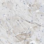 Filamin B Antibody in Immunohistochemistry (Paraffin) (IHC (P))