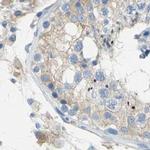 Filamin B Antibody in Immunohistochemistry (IHC)