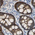 Filamin B Antibody in Immunohistochemistry (IHC)